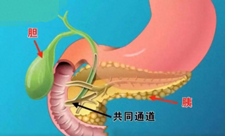 四川胆结石医院@中老年人：小心！您已进入胆结石高发人群行列！(图1)