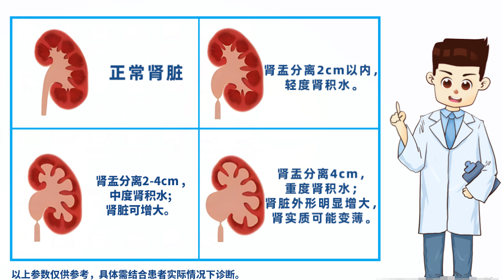 四川肾结石医院：肾结石引发肾绞痛时，为什么还会伴随恶心呕吐?(图3)