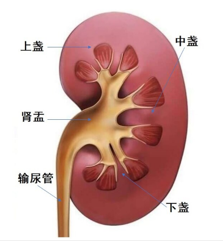 四川肾结石专科医院科普：肾结石是否能运动排石？如何正确治疗？(图2)