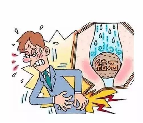 夏天和小龙虾啤酒更配？四川结石病医院专家提醒：当心结石找上门！(图4)