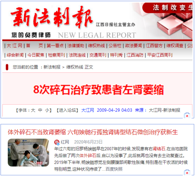 四川肾结石医院案例分享：来看看那些因为体外碎石“枯萎”的肾脏(图4)