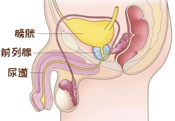 【成都前列腺专业医院】四川结石病医院瑞梦热蒸汽消融术，保住男性第一“腺”！(图2)