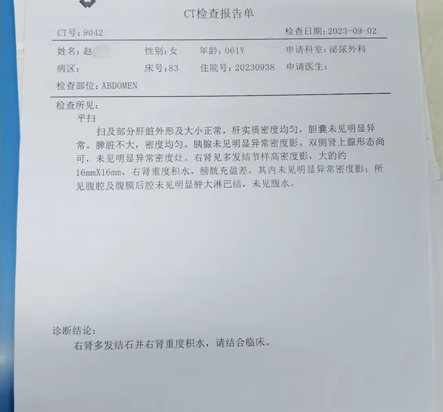 成都肾结石医院案例分享：遗憾！小小肾结石竟毁掉了她的一颗肾脏(图2)