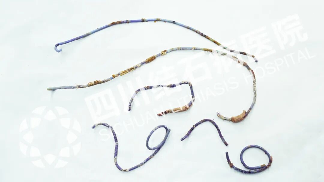 2025年度|四川结石病医院泌尿外科：锚定精准医疗，深耕亚专业建设(图7)